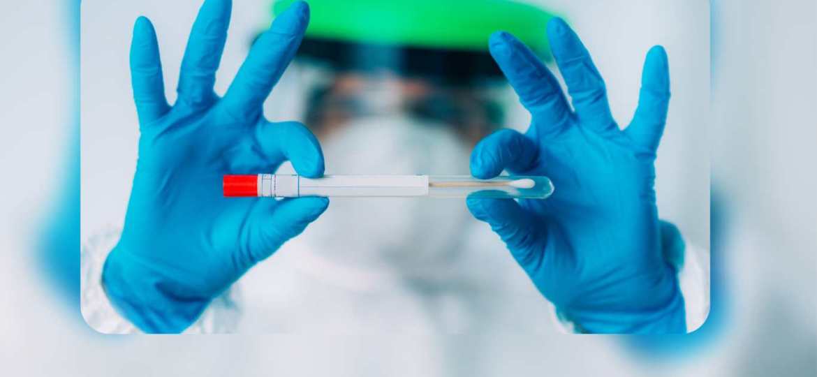 rt PCR Test (Website)